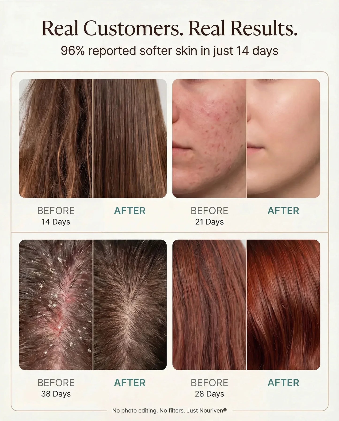 Nouriven® Shower Filter - Nouriven