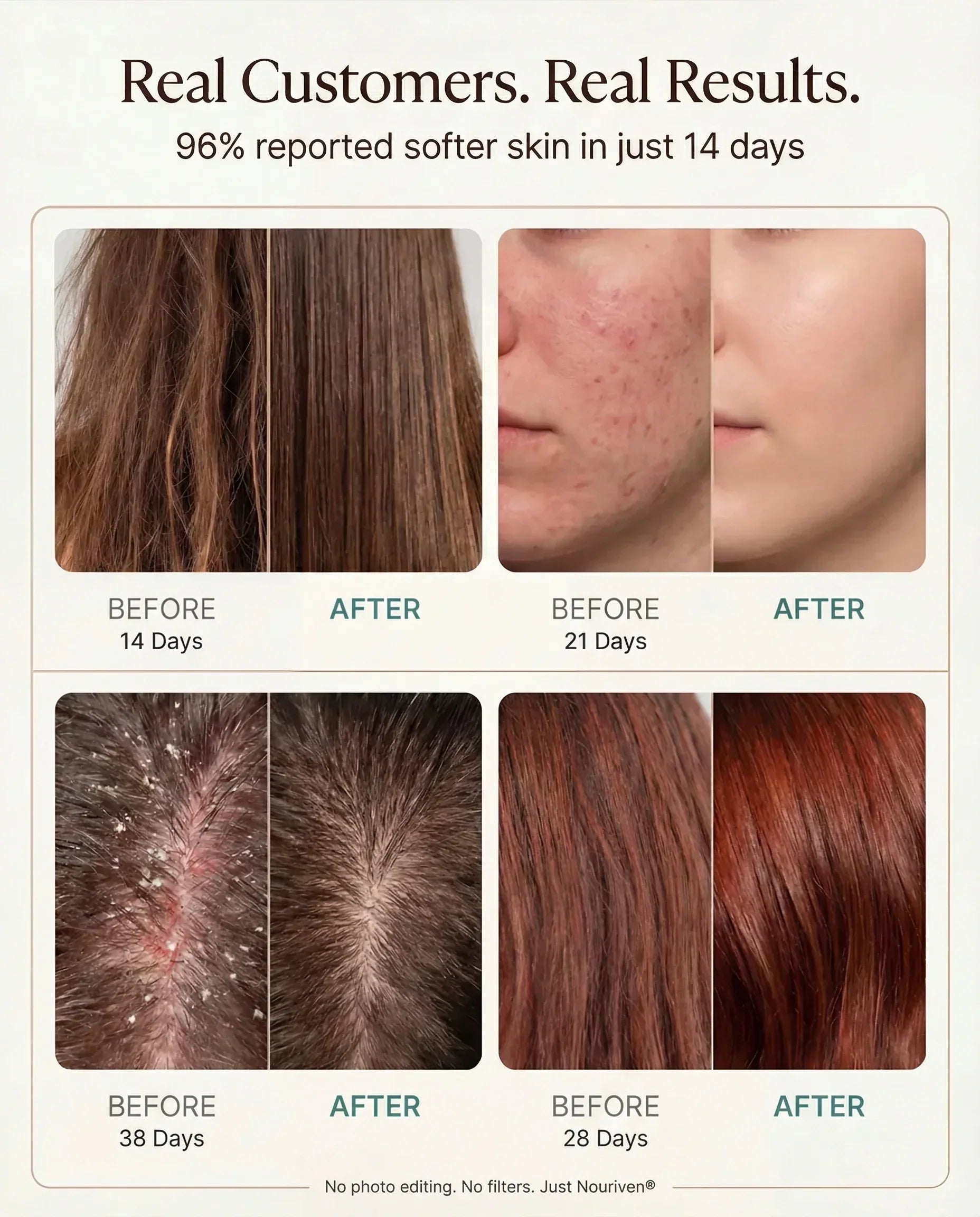 Nouriven® Shower Filter - Nouriven