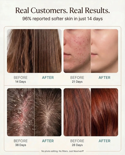 Nouriven® Shower Filter - Nouriven