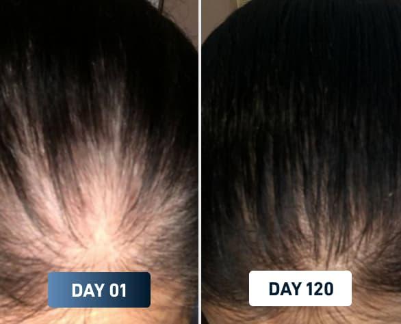 shedding3 - Nouriven